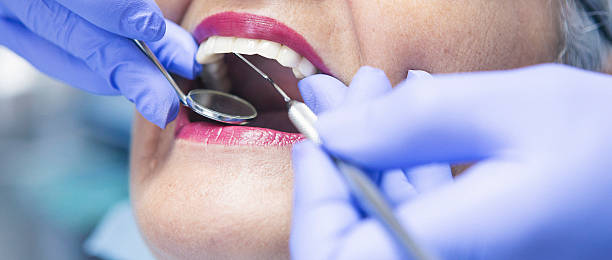 Best Dental Abscess Treatment in Fort Oglethorpe, GA
